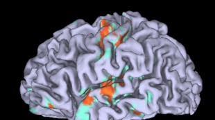 La menopausa cambia il cervello in modo diverso da pubert&agrave; e gravidanza