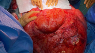 Tumori rari, a luglio torna il nastro giallo per la consapevolezza sui sarcomi