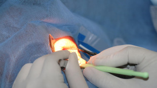 In Italia lo studio su staminali 'riprogrammate' per la cura della maculopatia