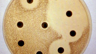 Epilessia resistente a farmaci, da batteri intestinali strategia per rallentarla