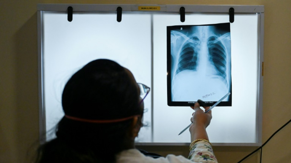 La tuberculose en plein come-back dans le monde, s'inqui&egrave;te l'OMS